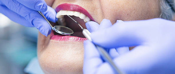 Best Emergency Dental Care for Broken or Chipped Teeth in , WV