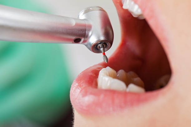 Best After-Hours Dental Trauma Care in , WV